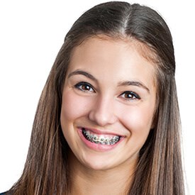 Orthodontic Options 