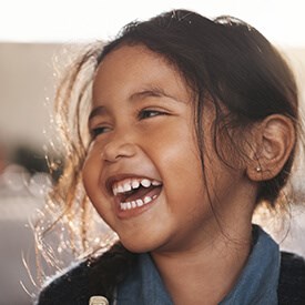 Tooth-Colored Fillings